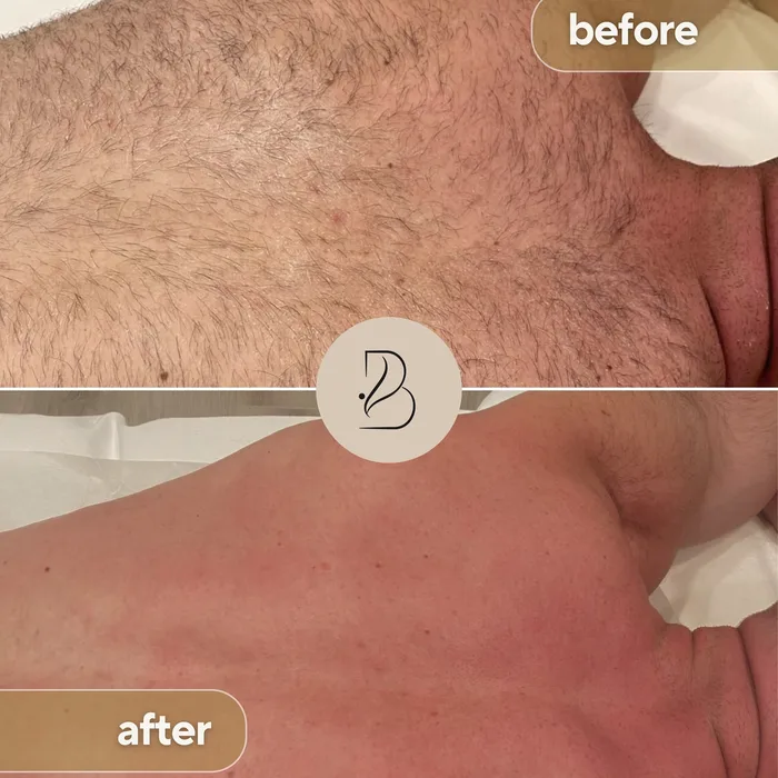Men's waxing before and after