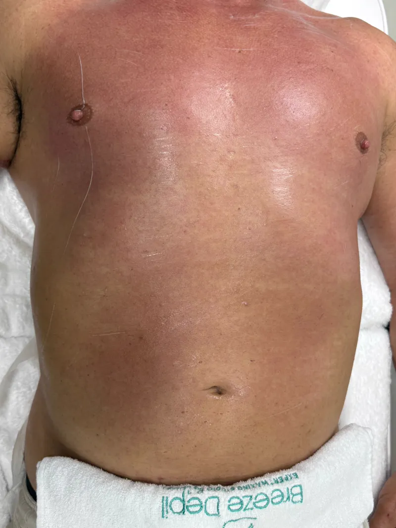Men's waxing at Breeze Depil